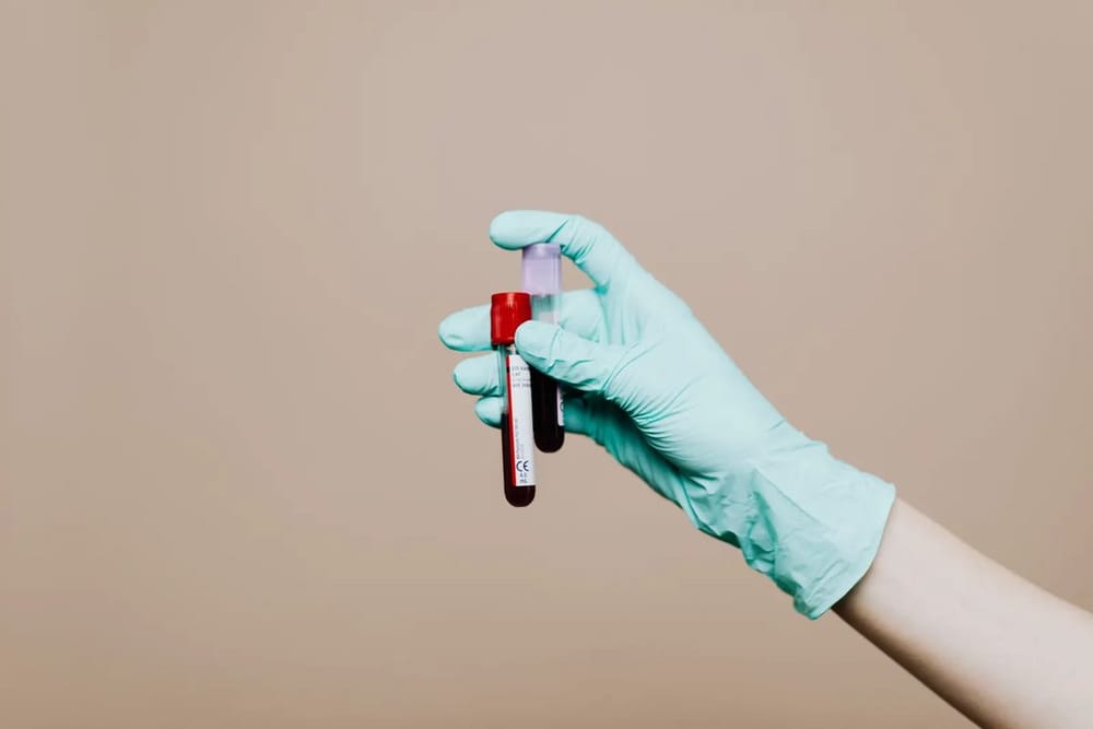 Iron Deficiency Without Anaemia: The Fatigue ‘Normal’ Blood Tests Miss