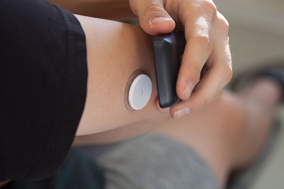Why Everyone's Suddenly Wearing a Glucose Monitor (and What the Evidence Actually Says)