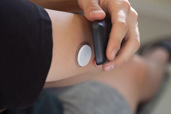 Why Everyone's Suddenly Wearing a Glucose Monitor (and What the Evidence Actually Says)